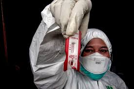 Rapid Test Dengan Hasil Negatif Covid 19 Harus Cek Lagi Setelah 10 Hari