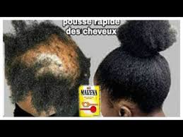 Melangez La Farine De Mais Avec Cette Ingredient Tes Cheveux Vont Poussee Plus Vit Pousse Des Cheveux Comment Faire Pousser Ses Cheveux Chute De Cheveux Remede