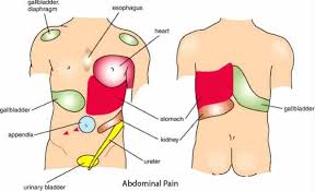 Pin On Gallstones
