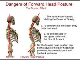 Pin On Posture And How To Improve It