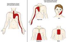Pin On Upper Back Pain