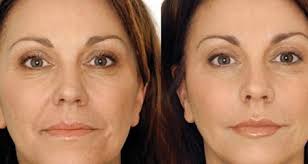 Voici Comment Utiliser De L Huile D Olive Pour Attenuer Les Rides Sante Beaute Les Rides Recette Beaute