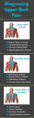 Pin On Back Pain Exercise