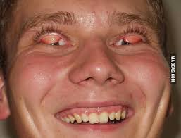 The chronicles of trippytrap : One Of My Biggest Fears In The Childhood Flipped Eyelids 9gag