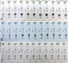 False Negative Rt Pcr And False Positive Antibody Tests Concern And Solutions In The Diagnosis Of Covid 19 Journal Of Infection