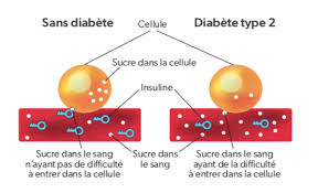 1,612 likes · 10 talking about this. Qu Est Ce Que Le Diabete Diabete Quebec