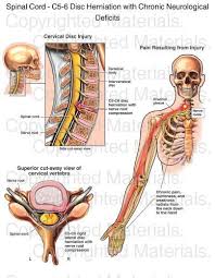 Pin On Brain Spine