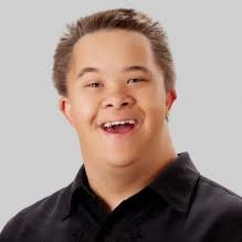 Down Syndrome Misconceptions Vs Reality Down syndrome (sometimes called down's syndrome) is a condition in which a child is born with an extra copy of their 21st chromosome — hence its however, people with down syndrome can live healthy and fulfilling lives. down syndrome misconceptions vs reality