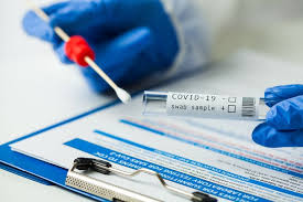 Wagub Dki Laporkan Ke Kami Jika Biaya Tes Swab Lebih Dari Rp 900 000