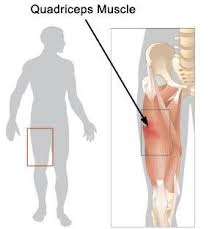 How To Strengthen Quads To Support The Knee Muscle Strain Thigh Exercises Bad Knee Workout