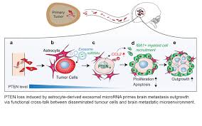 Why A Protein Causes Tumor Growth In Brain But Not Other Organs Cancer Frontline Cancer Newsletter From Md Anderson Md Anderson Cancer Center Tumor Brain
