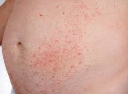 Pin On Natural Remedies Pain Relief