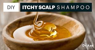 The Recipe To Treat Your Itchy Scalp Honey Benefits Food Dry Cough Remedies