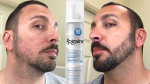 Make sure to apply moisturizer after minoxidil has dried (approximately 4 hours). How To Grow A Real Beard Minoxidil 4 Month Beard Journey Youtube