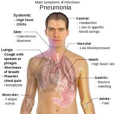 Pneumonia Pneumonia Symptoms Pneumonia Treatment Asthma Treatment