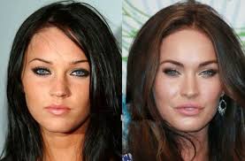 16 Celebs Who Are Unrecognizable After Plastic Surgery Hair Implants Plastic Surgery Celebrity Plastic Surgery