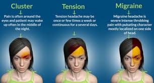 This Is How Headaches Reveal What Is Wrong With Your Health Headache Cluster Headaches Migraine