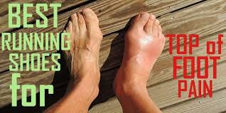 Pin On Top Of Foot Pain Running Shoes