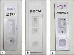 Using Prenatal Blood Samples To Evaluate Covid 19 Rapid Serologic Tests Specificity Springerlink