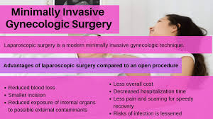 Why You Need Minimally Invasive Gynecologic Surgery Surgery Endometriosis Laparoscopic Surgery