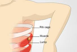 Pin On Diseases And Conditions
