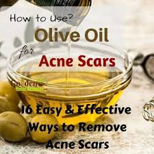 Pin On Acne Remedies Overnight