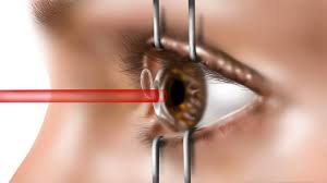 Pin By Best Laser Eye Surgery On Best Laser Eye Surgery Best Hospitals Laser Eye Surgery Cost Lasik Eye Surgery