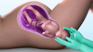 Birth of baby (vaginal childbirth). 3d Medical Animation Child Birth Process Youtube