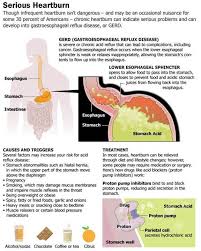Pin On Gastroesophageal Reflux Disease