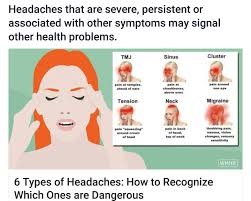Headaches Headache Types Headache Types Of Headaches Chart