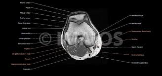 Radiology imaging medical anatomy human anatomy and physiology anatomy study. The Knee Mri Atlas Of Anatomy In Medical Imagery