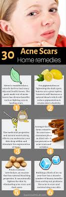 Pin On Acne Care