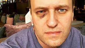 Russian opposition leader alexei navalny has been taken to hospital after an antiseptic green dye was splashed on his face in moscow. Putin Critic Navalny Has Eye Surgery In Spain After Attack Bbc News