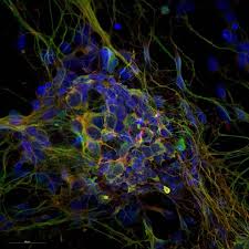 Zeiss Microscopy On Instagram Maximum Intensity Projection Of Neurosphere Multi Color Label With Dapi Blue Tubulin In 2020 Multi Color Art Inspiration Microscopy