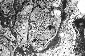 The sem and esem are microscopes that. Renal Pathology