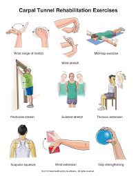 Summit Medical Group Carpal Tunnel Syndrome Exercises Rehabilitation Exercises Hand Therapy Carpal Tunnel Surgery