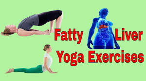 Fatty Liver Yoga Exercises Fatty Liver Fatty Liver Disease Liver