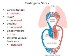 Pin By Evangalyn Carter On Rn Cupcake Cardiogenic Shock Body Tissues Pediatrics