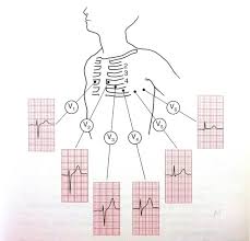 Ecg Ekg Interpretation Oxford Medical Education