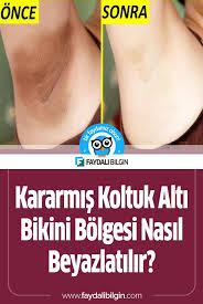 Kararmis Koltuk Alti Ve Bikini Bolgesi Nasil Beyazlatilir Faydali Bilgin Koltuk Alti Dogal Cilt Bakimi Dogal Saglik