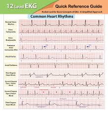 Ekg Pocket Card Harilal Nair Dnp Aprn 9781941004067 Amazon Com Books