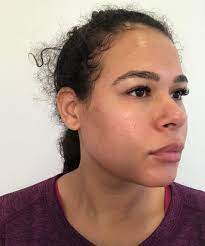 On adore ces petites touches qui finissent un look. L Arret De L Alcool Les Bienfaits Sur Le Visage