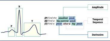 Ssts A Syntactic Tool For Pattern Search On Time Series Sciencedirect