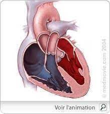 Tout comprendre en 2 min. Insuffisance Cardiaque Facteurs Prevention Et Traitements