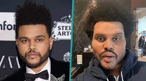 I tried to look like @theweeknd but wound up looking like @pitbull if he got attacked by a pitbull. The Weeknd Shocks Fans With Drastically Different Looking Face Access