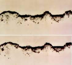 Amyotrophic lateral sclerosis (als), or lou gehrig's disease, is a fatal degenerative neurological condition that causes progressive weakening. Alse Wikipedia