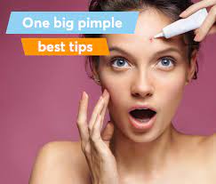 Toothpaste On Pimples Dermatologist S Opinion Mdacne