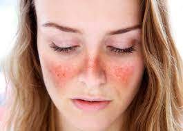 Eau hydratante qui protège des uv. Boutique Bio Plaque Rouge Sur Visage Produits Cosmetiques