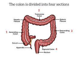 About Colorectal Cancer Symptoms Risk Factors Diagnosis Stages Saint John S Cancer Institute Santa Monica Ca