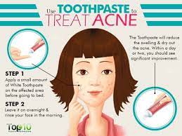 Did You Know These Uses Of Toothpaste How To Treat Acne Acne Remedies Cystic Acne Remedies